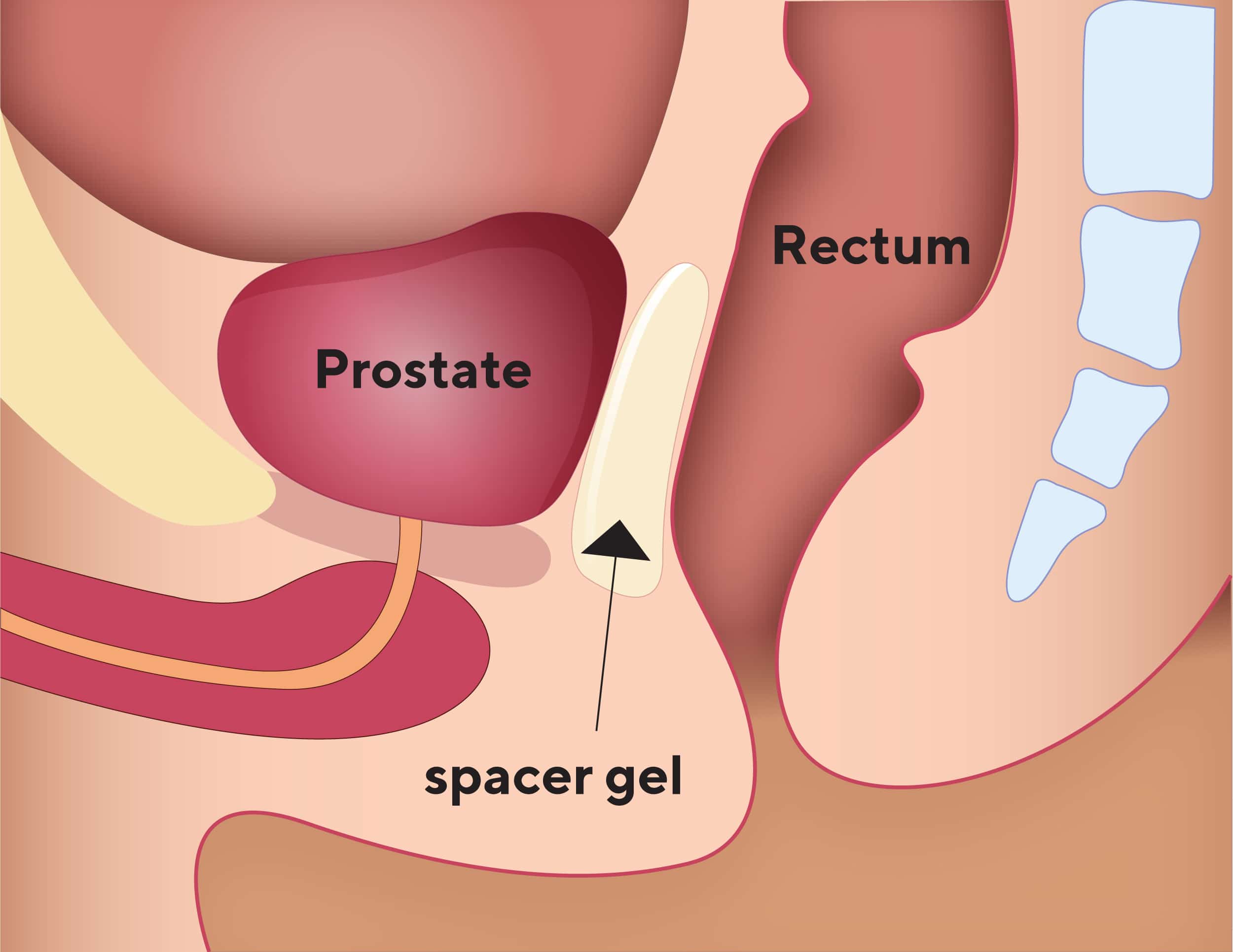 Bowel Function